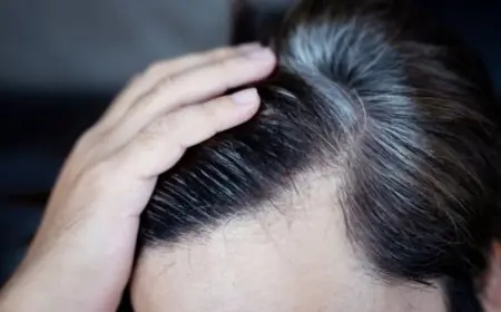 Penyebab Uban Muncul di Usia Muda dan Cara Mencegahnya